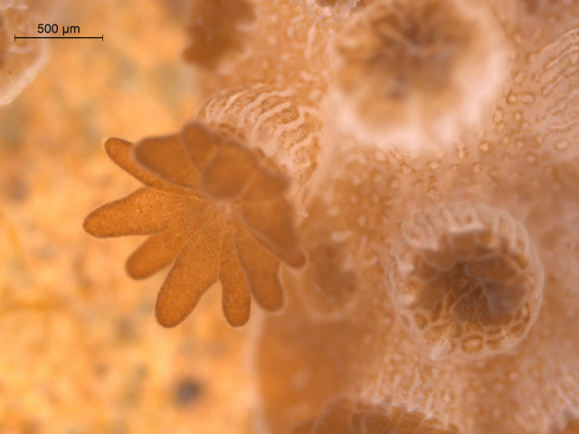 Microscope view of hard coral polyps showing zooxanthellae
